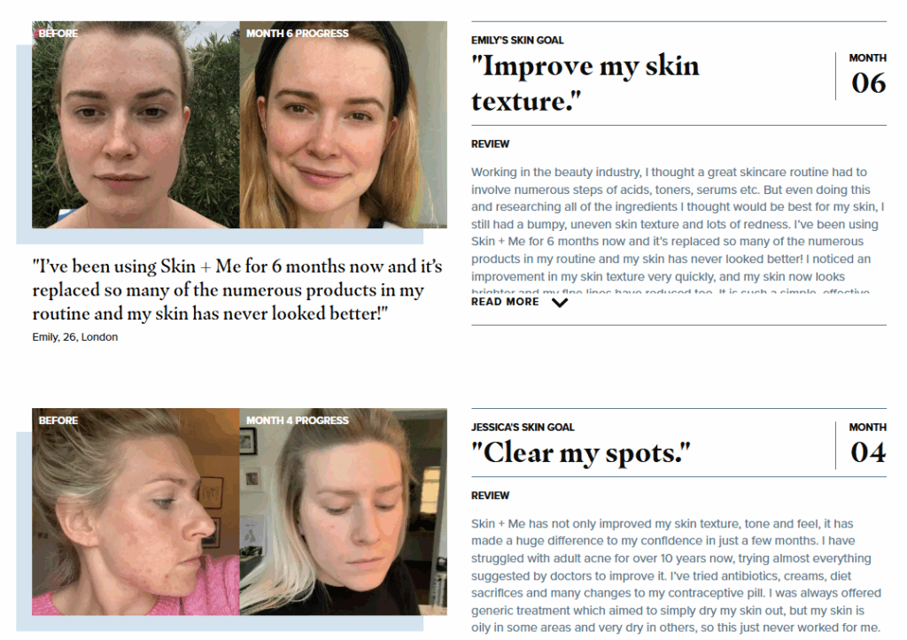 UGC Before-and-After Gallery on Skin+Me Store - Features of Makeup and Skincare Ecom Site